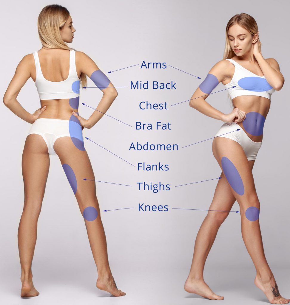imagen de las partes del cuerpo que pueden ser tratadas con Jplasma
